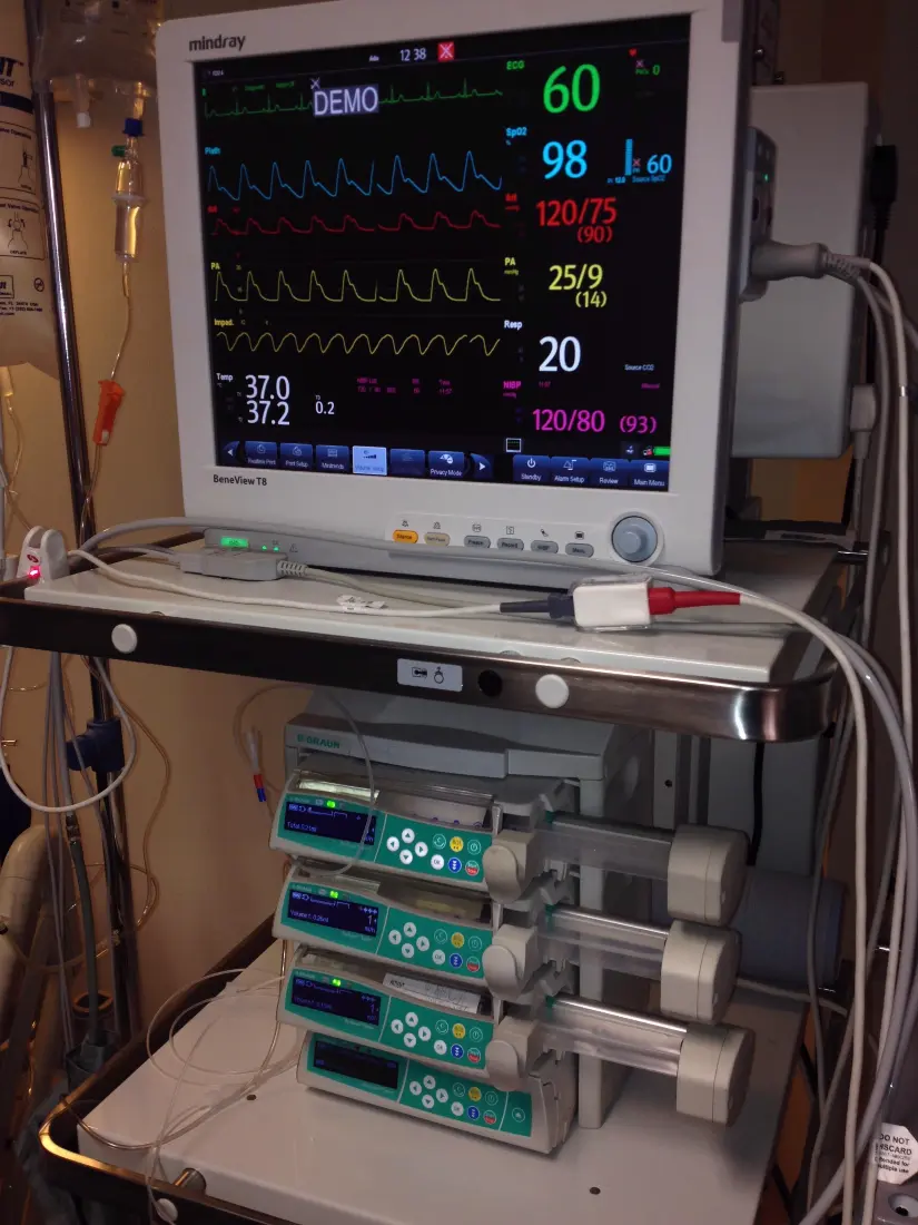 Vital Signs Monitor & Syringe Drivers