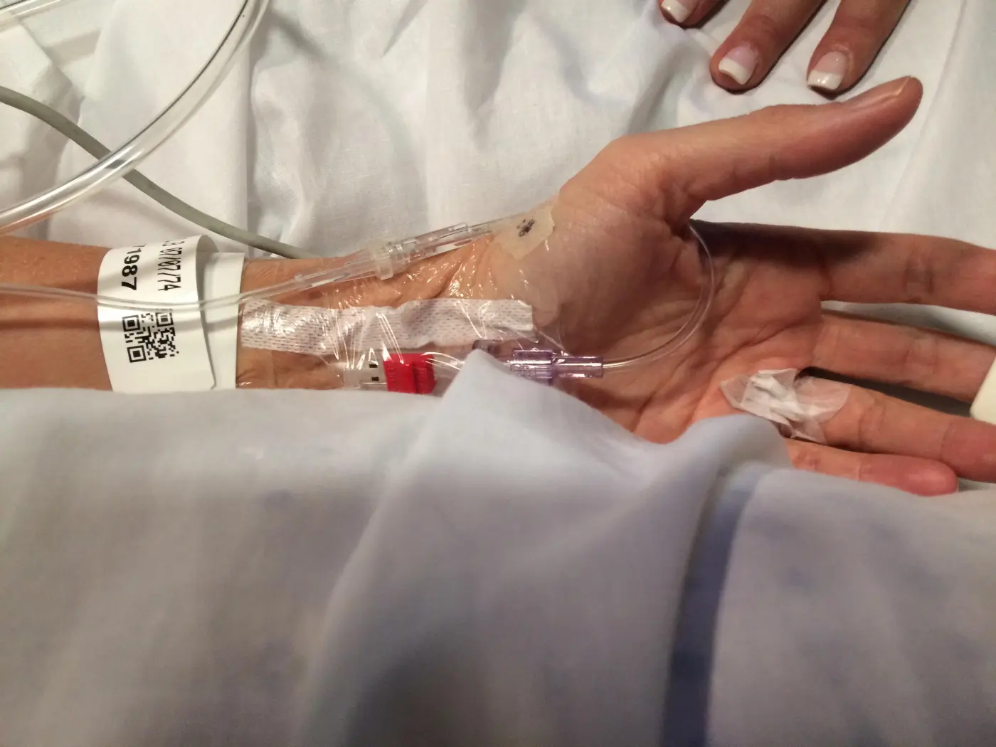 Intravenous equipment in hand