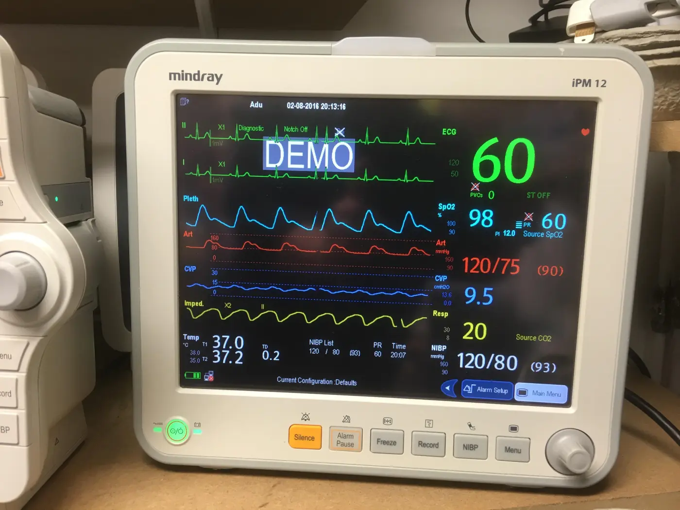 Vital signs monitor